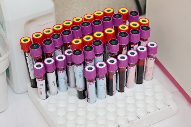 Rows of sample vials arranged in a laboratory ready for analysis