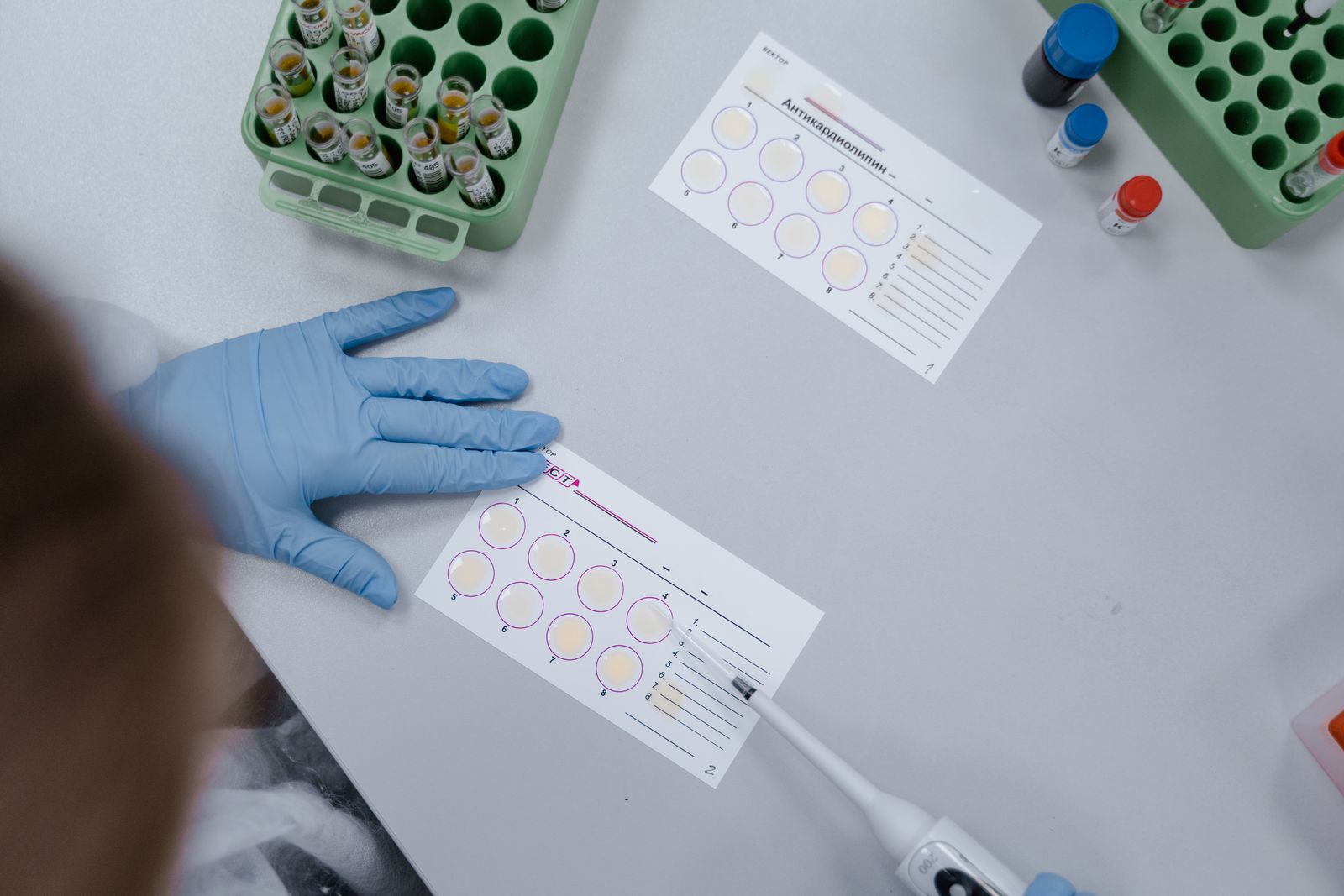 Overhead view of a scientist analysing samples with laboratory equipment