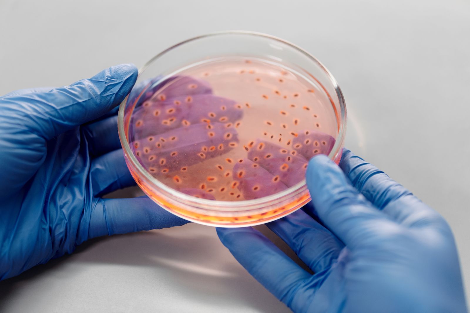 Gloved hands holding a petri dish containing a culture