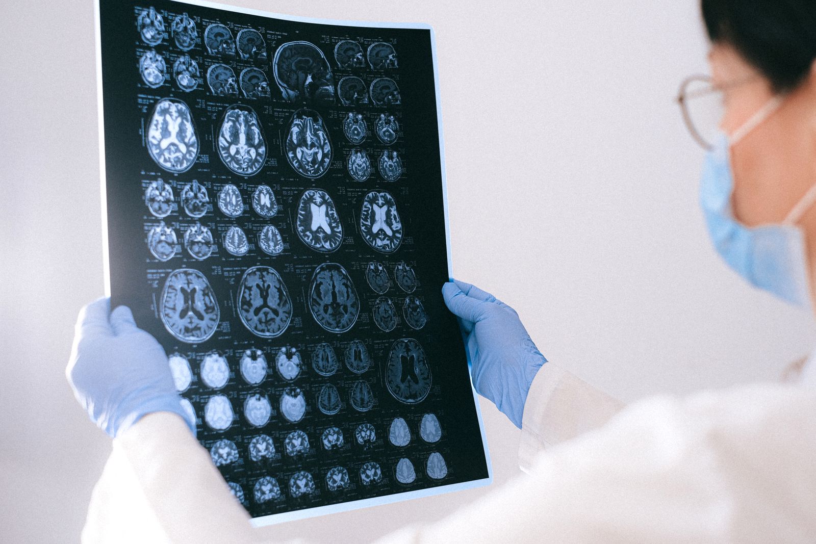 A medical professional reviewing MRI scans in a clinical setting