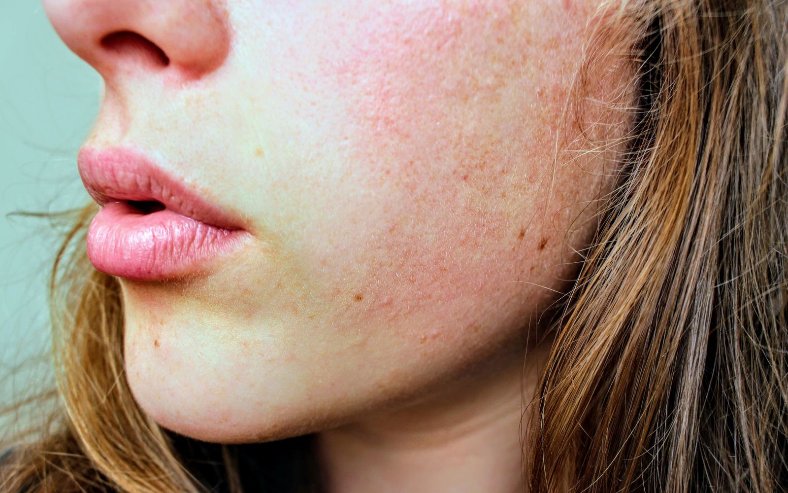 Close view of facial skin showing natural texture