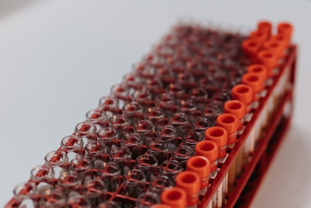 Laboratory test tubes arranged in a rack ready for analysis