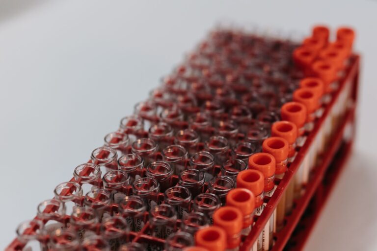 Laboratory test tubes arranged in a rack ready for analysis