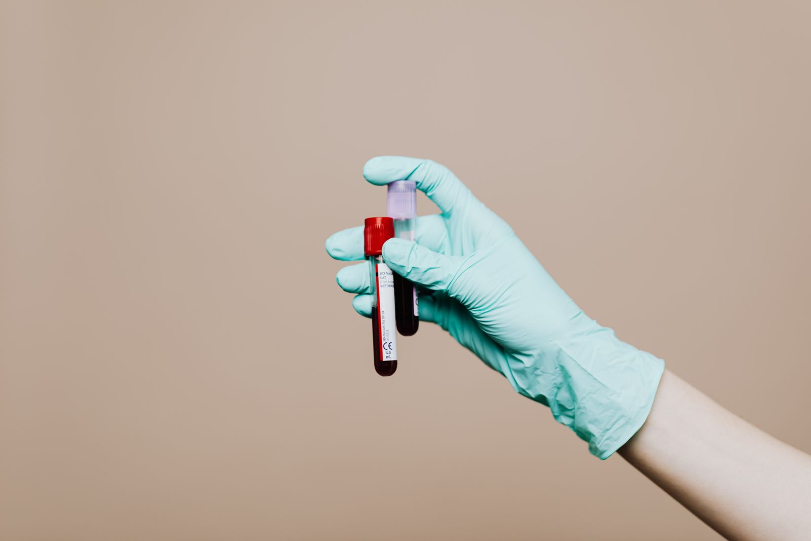 Gloved hand holding labeled sample tubes against a neutral background